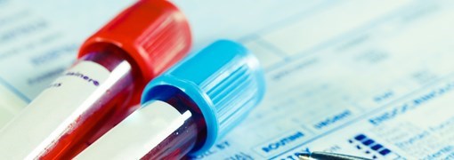 בדיקת רמת Immunoglobulin G - תמונה